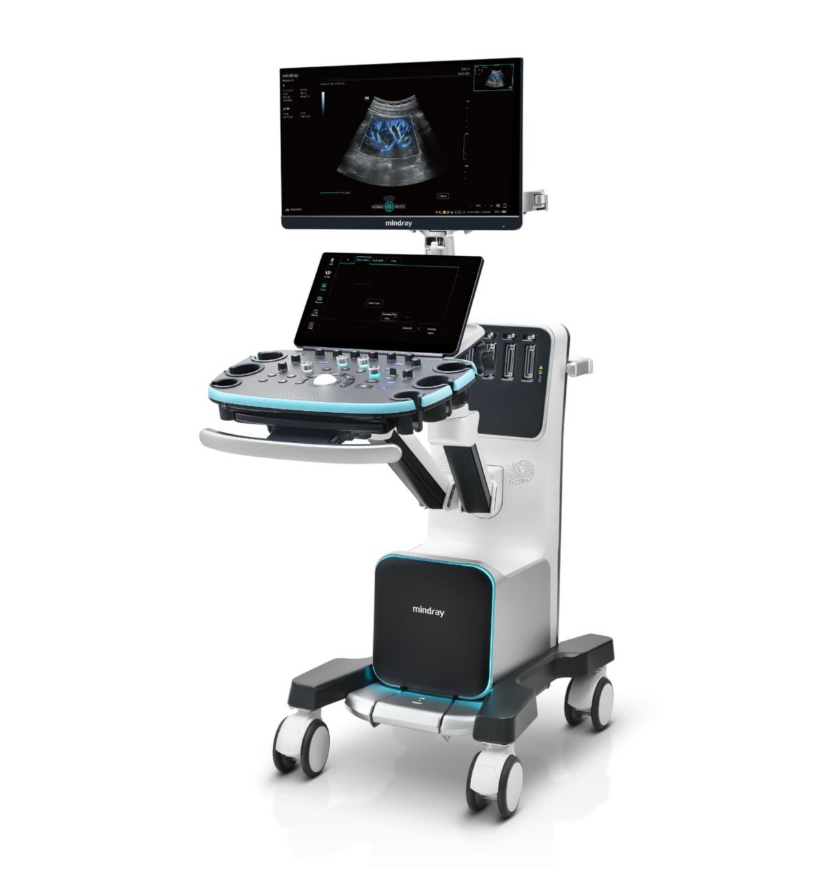 Omexa diagnostic ultrasound system cart